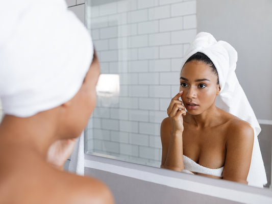 How to prevent blackheads