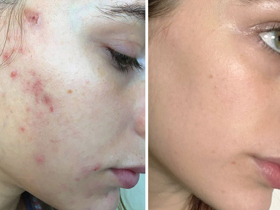 Feel Confident in Your Skin Again!