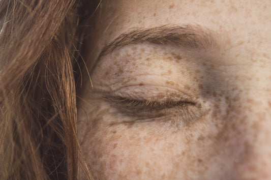 Sun Damage: Fighting Photo-Aging