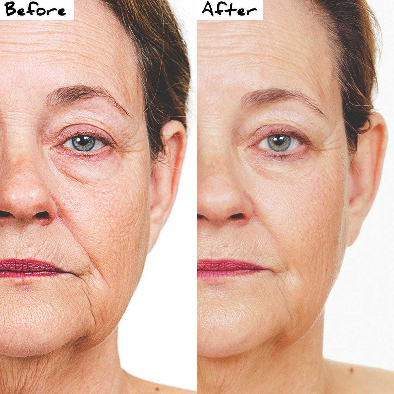 before and after from using the Nano Mask anti-aging face mask