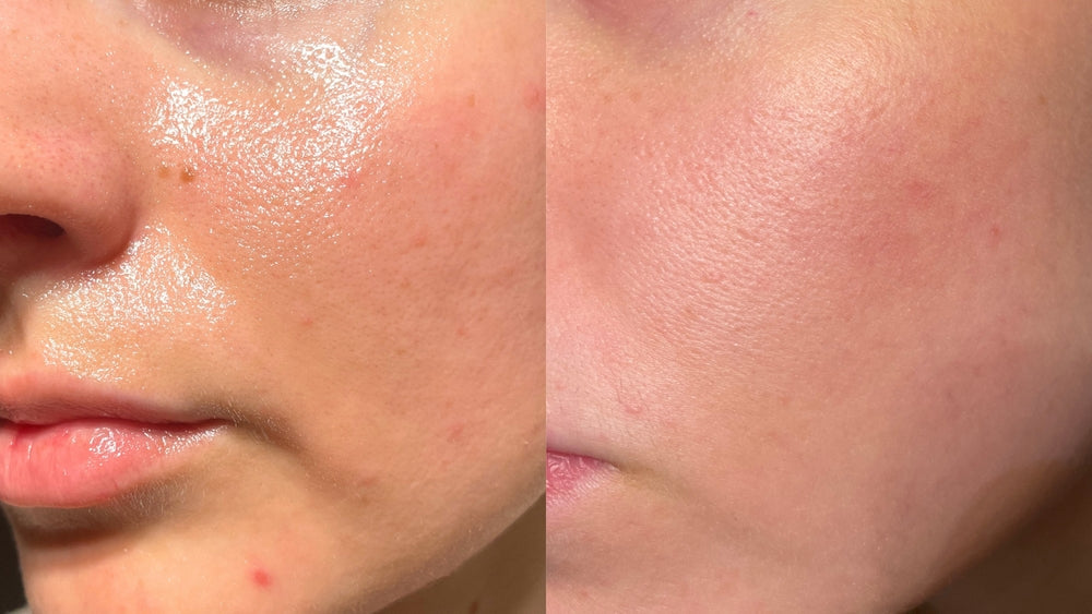 The 12 Best Face Oils in 2026, Ranked by Formula and Skin Type
