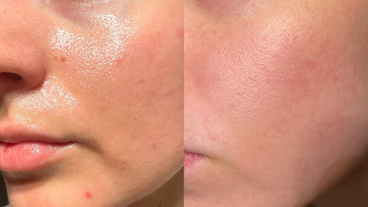The 12 Best Face Oils in 2026, Ranked by Formula and Skin Type