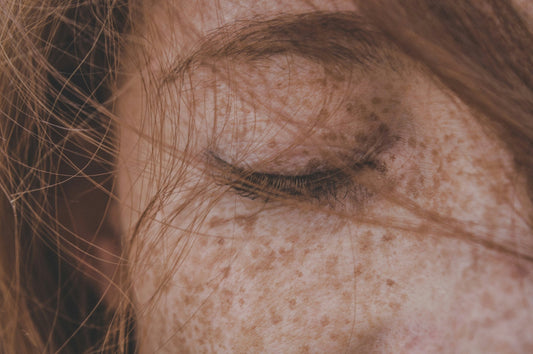 Sensitive Skin Care: How to Identify, Treat, and Prevent Flare-Ups