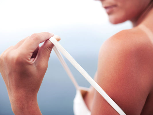 home remedies for sunburn relief