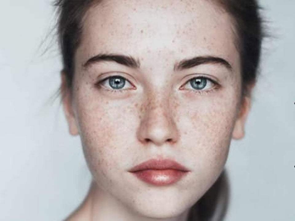 Help with hyperpigmentation and dark spots