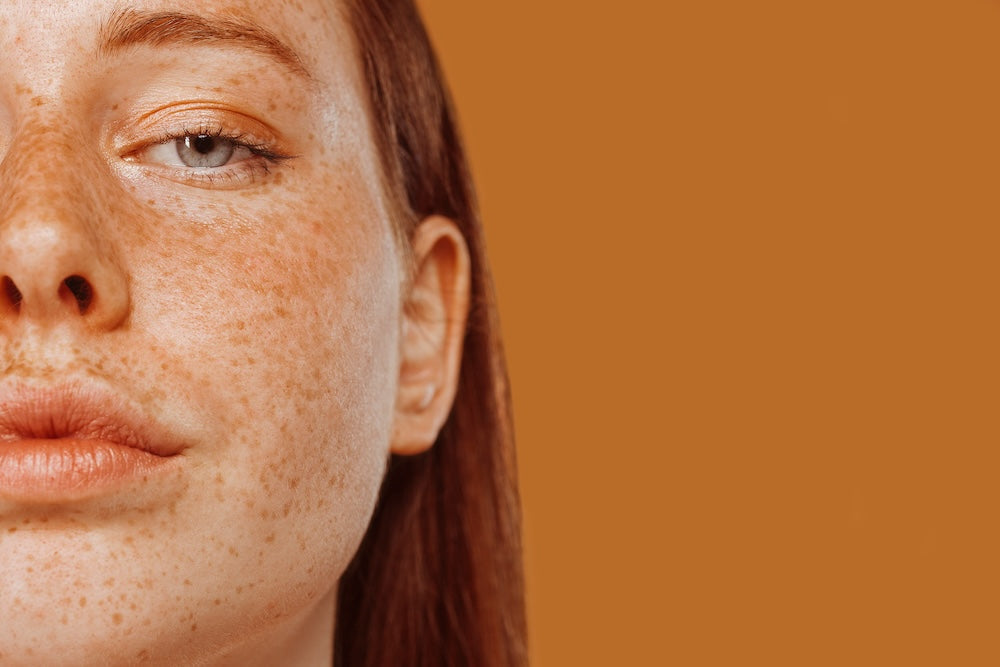 Decode blemishes, bumps, and other common skin concerns