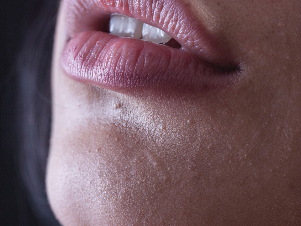 Bumpy Texture On Face