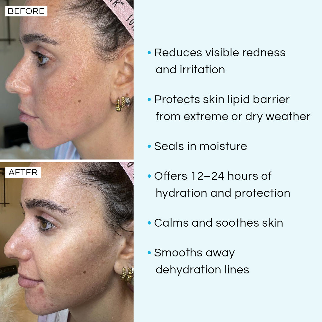 Blue Butterfly Balm benefit callout – 24-hour hydration and skin barrier protection
