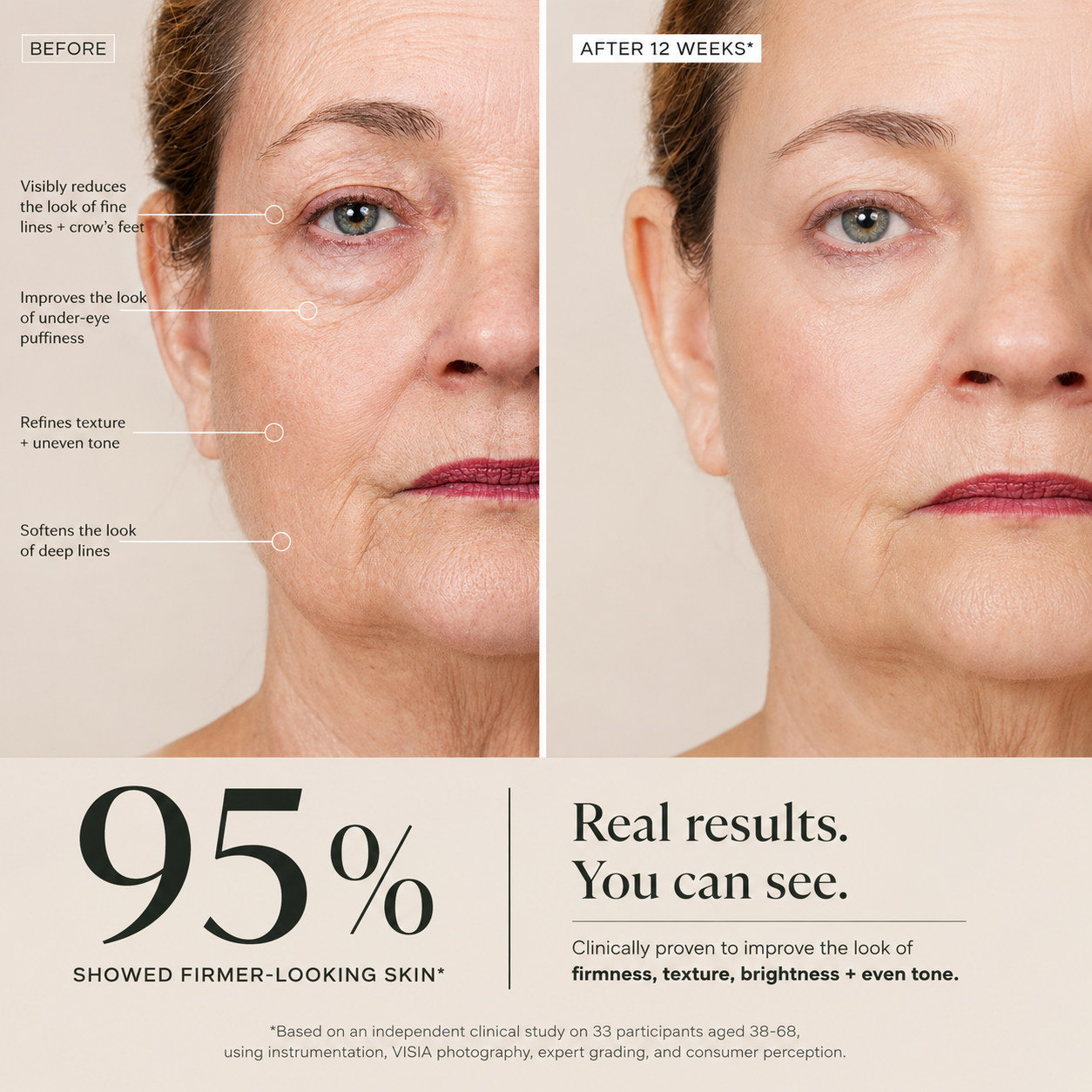 In a clinical study, 95% of Retinu users said their skin looked firmer and younger after 12 weeks