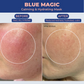 Blue Magic face mask reduces redness, increases hydration, and calms inflammation
