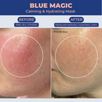 Blue Magic mask reduces redness, increases hydration, and calms inflammation