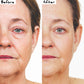 before and after from using the Nano Mask anti-aging face mask