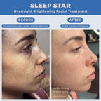 Sleep Star before and after – visible dark spot reduction and brighter complexion